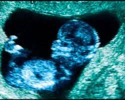 12 Semanas De Gravidez