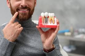 Key Benefits of Choosing Dental Implants