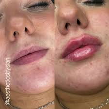 💉 Sculpting Shapes 💉, First time...