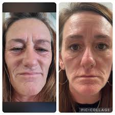 Has anyone been to Skin180 Aesthetics? Do you have any comments or reviews?  Did you love it?