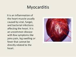 Myocarditis definition myocarditis is an inflammatory disease of the heart muscle (myocardium) that can result from a variety of causes. Different Types Of Heart Disease