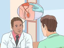 علاج الإمساك المزمن Wikihow