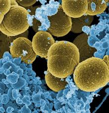 What Is Sepsis When You Get An Infection Your Body Tries To Fight It With Your Immune System Sepsis Occurs When Your Immune Syste Microbiology Bacteria Mrsa