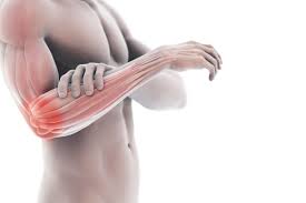 The outside of your elbow will feel sore, tender, weak, and maybe even hot and swollen, says dr. Tennis Elbow Symptoms Causes Diagnosis And Treatment