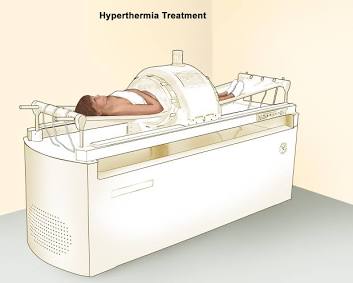 Regional Hyperthermia Treatment, AI generated