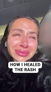 I've been meaning to put this up for a while but it's been hard for me to  get to a place where I'm comfortable enough to share this with you all. ,  So for the last year I've had this uninvited, full ...