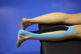 Dolor En El Tendon De Aquiles Y El Vendaje Neuromuscular Kinesio Taping Exercise Character Shoes