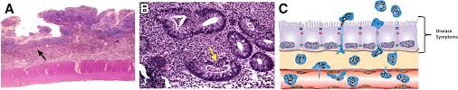 Listen to papa moll im schnee by papa moll on deezer. Neutrophil Epithelial Interactions The American Journal Of Pathology