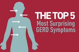 Gerd stands for gastroesophageal reflux disease, which is the backflow of stomach contents (including stomach acid) upward into the esophagus (the swallowing tube that extends from the mouth. Top 5 Most Surprising Gerd Symptoms Temple Health