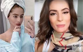Video obsahuje video na kanály týnuš třešničková satirický a ironický humor. Tynus Tresnickova Se Odhodlala Ukazat Zjizvenou Tvar A To Kvuli Sikane Expres Cz