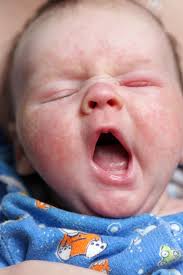 Brands (a to z) clarins. Five Things You Can Do To Protect Your Child S Skin This Winter