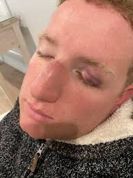 Lachlan Miles Support Page