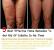 Cellulite Before And After Squats