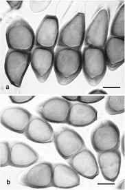 Image result for Berkheya speciosa