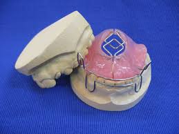 Aparat elanlari 2021 bakida ucuz qiymete aparat satilir. Studium Techniki Dentystycznej Km Dental Wroclaw Aparaty Czynnosciowe I Mechaniczno Czynnosciowe