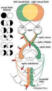 Visual Field Chart Interpretation Www Bedowntowndaytona Com