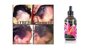 This usually happens, as chemically damaged hair have damaged hair follicles and scalp. Trl Faster Hair Growth Solution Black Castor Oil Coconut Oil Olive Oil Ninthavenue Europe