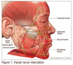 Bell S Palsy To Treat Or Not To Treat