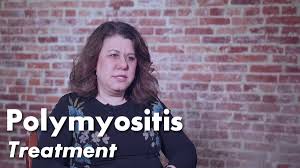Image result for Polymyositis