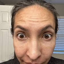 BUCKINGHAM CENTER FOR FACIAL PLASTIC SURGERY