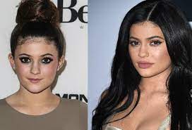 19.11.2014 · after her first surgery, the 1937 born actress then took up her role in that gal, a role that won her a golden globe award in addition to multiple emmy nominations. New And Improved The Top 15 Celebrity Plastic Surgeries For The Win