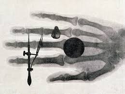 Wilhelm Roentgen Discovers The X Ray A Picture From The Past Wilhelm Rontgen Wilhelm X Ray