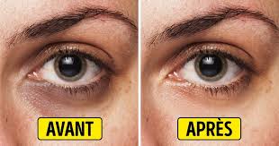 Le step by step : 8 Methodes Economiques Et Efficaces Pour Faire Disparaitre Les Cernes Sous Les Yeux
