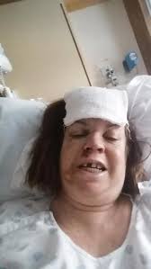 Fundraiser for Kathy Molitor by Sandy Gulliver : Kathy Molitor's Medical  Fund