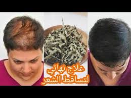 ضعيها على شعرك والفراغات سينمو شعرك بدون توقف ولن يتساقط بعد اليوم يقوي ويطول الشعر مثل السحر Youtube In 2020 How To Dry Basil Herbs Dried