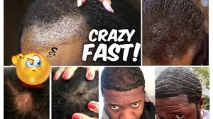 The most versatile essential oil on the planet, lavender essential oil ( where to get it) is another one of the best essential oils that stimulate hair growth. Best Oil For Faster Hair Growth Your Hair Will Grow Like Crazy Youtube
