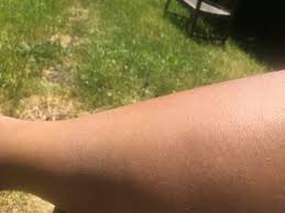 At groupon you can save up to 70% with brilliant vouchers. My At Home Hair Removal Ipl Review And Journey The Mini Braid Method