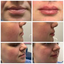 Good morning all, here at McIntyre Corbett and associates we are delighted  to welcome Dr Fiona Purss General Dental Council registration 152033 to  join our team here in Dingwall. She combines technical