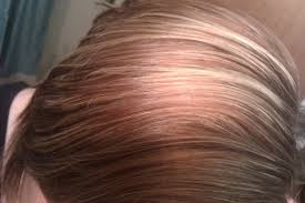 I just want to share with you how my hair reacted to revlon frost and glow highlighting kit.i did not leave the dye for a long time because i am s. Revlon Color Effects Frost Glow All In One Easy Highlighting Kit Reviews Photos Ingredients Makeupalley