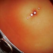 Bottom Belly Button Piercing Procedure Healing Aftercare Pictures