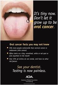 Image result for white cancer on tongue)