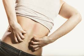 Virus hiv dapat masuk ke dalam sel darah putih dan merusaknya, sehingga jumlah sel darah putih yang berfungsi sebagai pertahanan tubuh terhadap infeksi akan menurun. Bagaimana Hiv Mempengaruhi Kulit Anda Hello Sehat