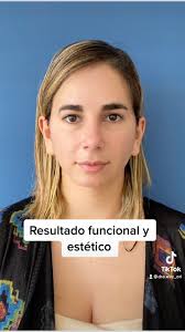 Evelyn de la Cruz. 👩🏻‍⚕️Otorrino (@dra.eve_orl) · Instagram 照片和视频