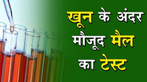 The content is not intended to be a substitute for professional medical advice, diagnosis, or treatment. Esr Test à¤¸ à¤‡à¤¨ à¤¬ à¤® à¤° à¤¯ à¤• à¤¬à¤¡ à¤¹ à¤†à¤¸ à¤¨ à¤¸ à¤ªà¤¤ à¤²à¤— à¤¯ à¤œ à¤¸à¤•à¤¤ à¤¹ Youtube