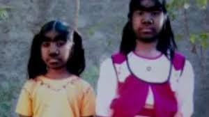 Losing about 100 strands of hair a day is natural; Child Suffering From Rare Werewolf Syndrome Has Left Mother Heart Broken