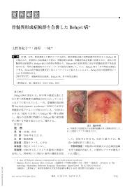 写小篆很费时间，于是秦代人把小篆作了改进,创造出便于书写的新字体录书。 到汉代,汉隶成为主要通行字体。 录书打破了古汉字象形的特点，为楷书的出现作了准备。 楷书出现在汉代晚期，但是在隶书的基础上形成了的。 录书一出现，方块的汉子就定型了。 éª¨é«„ç•°å½¢æˆç—‡å€™ç¾¤ã‚'åˆä½µã—ãŸbehcetç—… è‡¨åºŠçš®è†šç§' 61å·»13å· åŒ»æ›¸ Jp