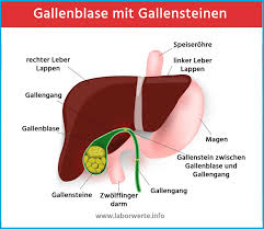 Erfahren sie mehr über symptome, ursachen und risikofaktoren. á… Gallenblase Gallenstein Aufbau Funktionen Therapie Bei Storungen