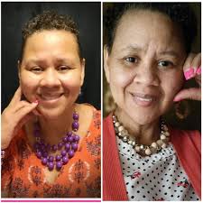 Tried to get a nice picture of 48 year old Peaches and this what I get. 🙄  I can confirm she is at a good weight and in a silly mood