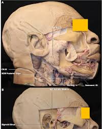 When your lymph nodes become swollen it is called. Https Www Mdpi Com 2076 3425 10 12 953 Pdf