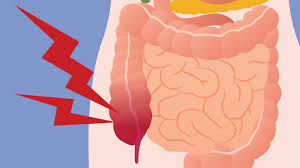 Here S What May Be Causing Your Digestive Gas Pain Everyday Health