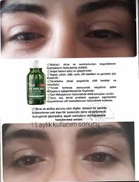Hacer Adli Kullanicinin Farmasi Panosundaki Pin Dogal Tedaviler Cilt Bakimi Serum