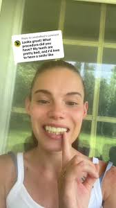 Replying to @LetsBeReal the 7k out of pocket is also covering the  permanents ill be getting installed in a couple months once we do round two  of impressions and get them made with the porcelien for a ...