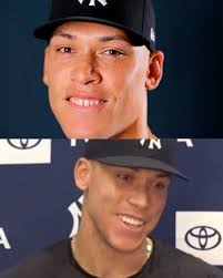 New York Yankees OF Aaron Judge has a brand new smile 😀