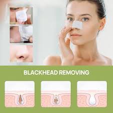 Amazon.com : LANBENA Blackhead Remover