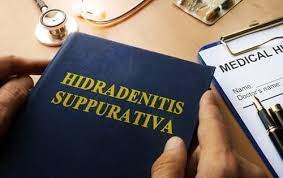 Social Security Disability For Hidradenitis Suppurativa Social Security Disability Doctor Names