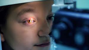 Crstg | Europe Edition | Corneal Haze After Prk Enhancement Of Prior Lasik